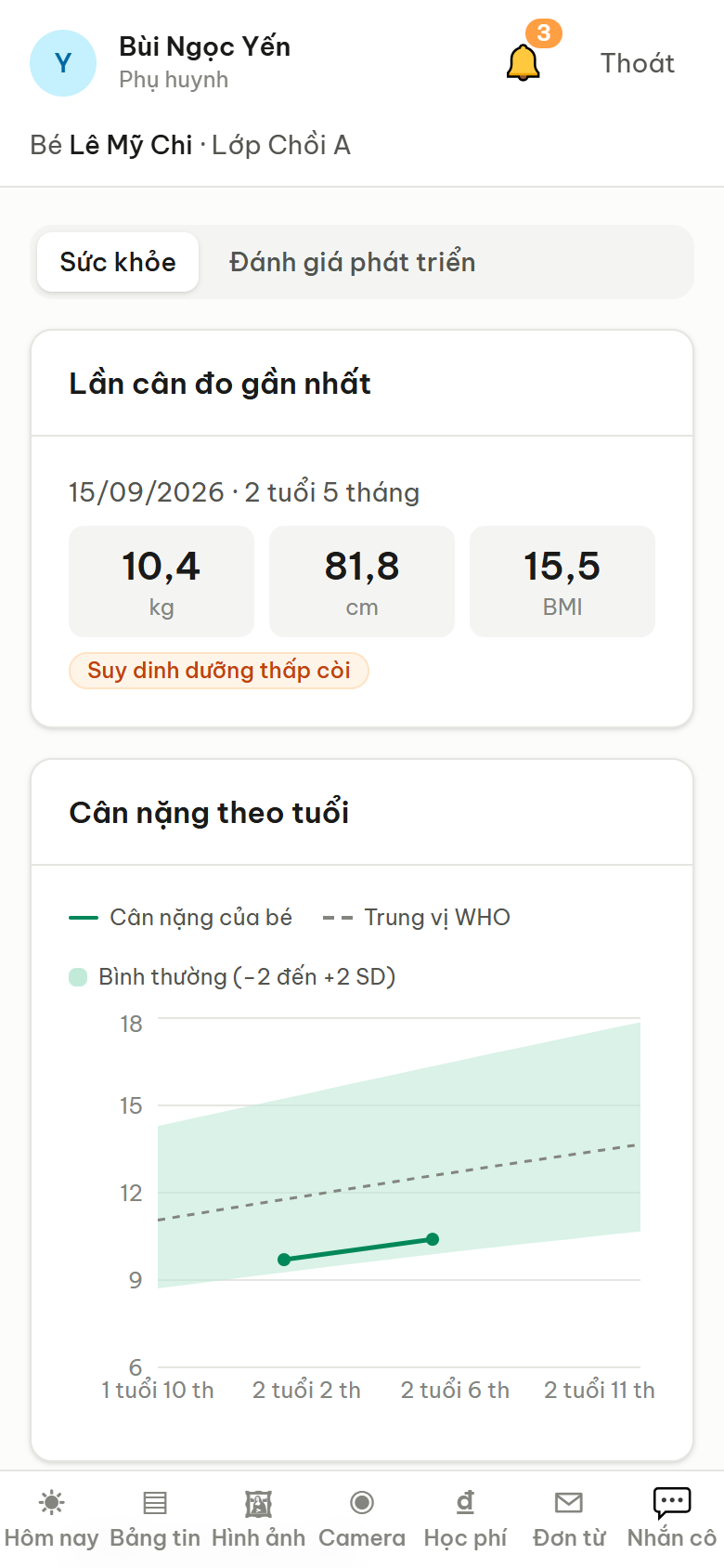 Biểu đồ tăng trưởng của bé theo chuẩn WHO